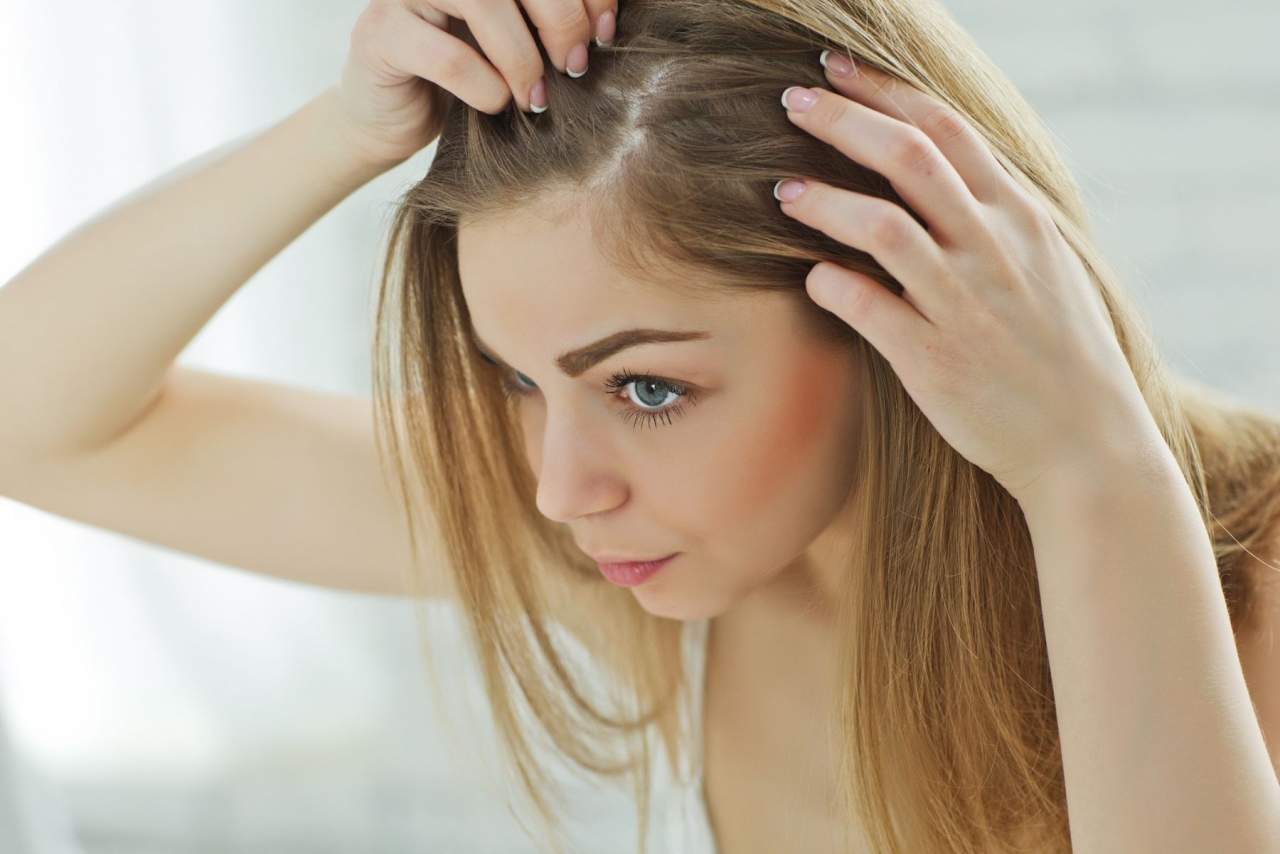 ¿Son las prótesis capilares a medida el futuro?: Soluciones de My Special Hair
