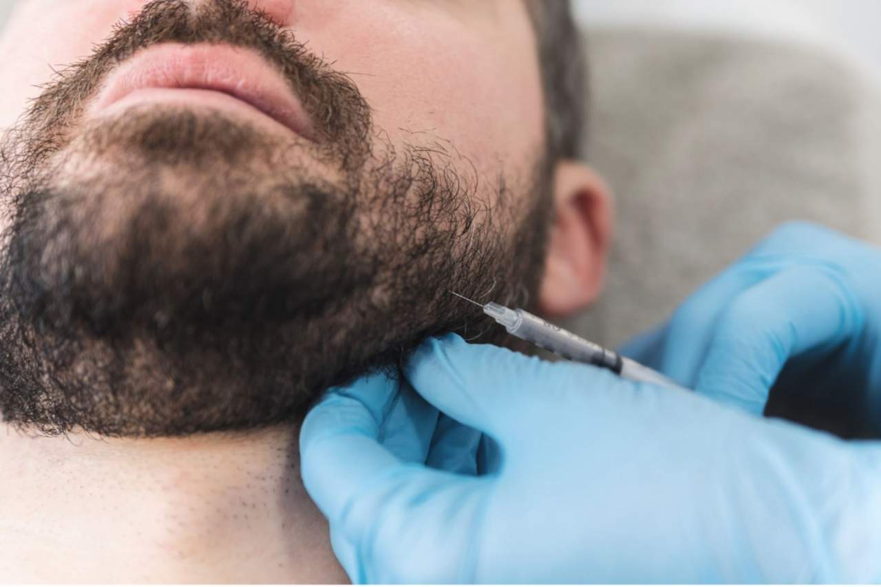 Dr. Carlos Zito: masculinización facial