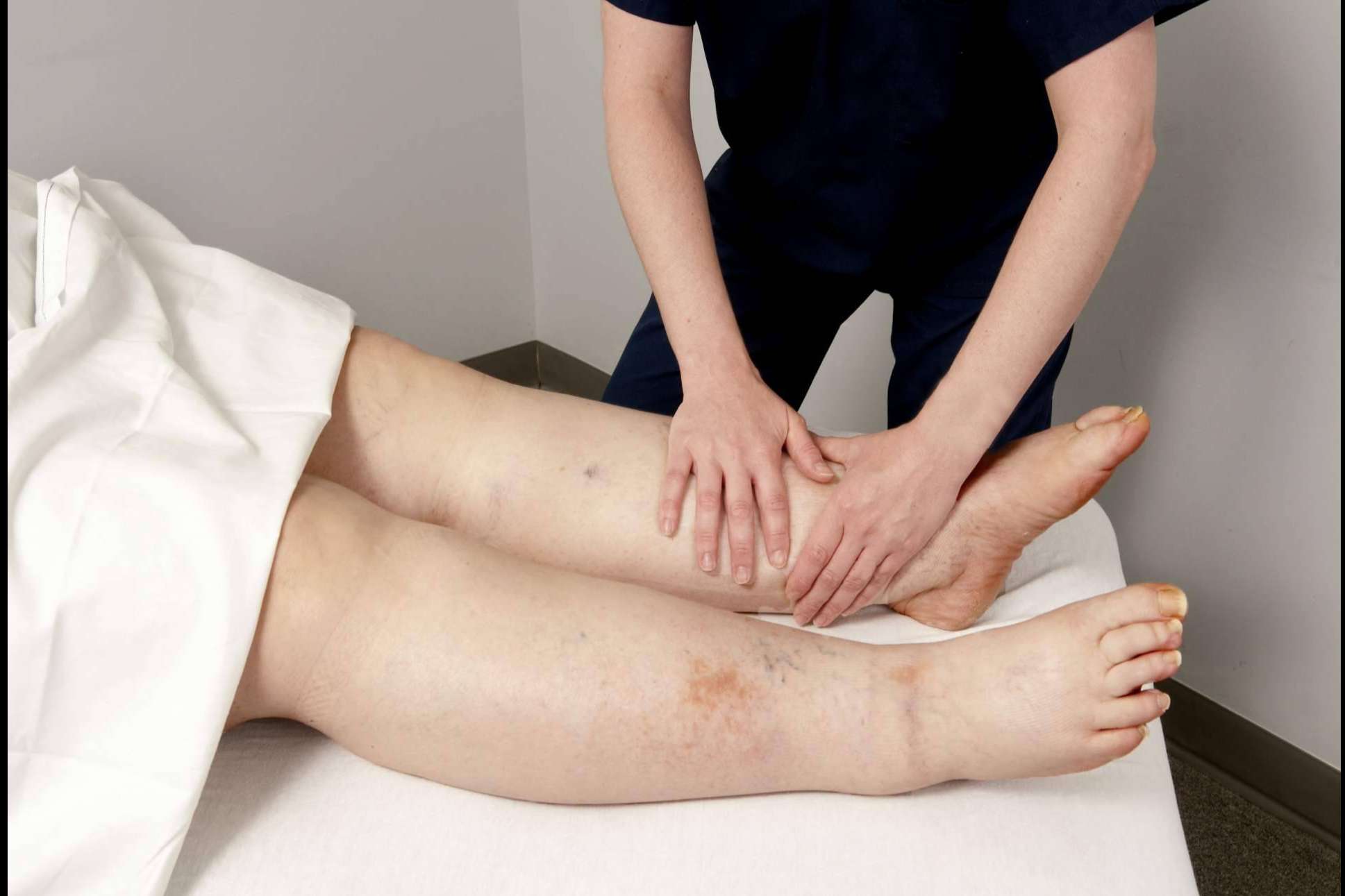 Clínica Mimar Fisioterapia: expertos en el tratamiento del linfedema en Valencia