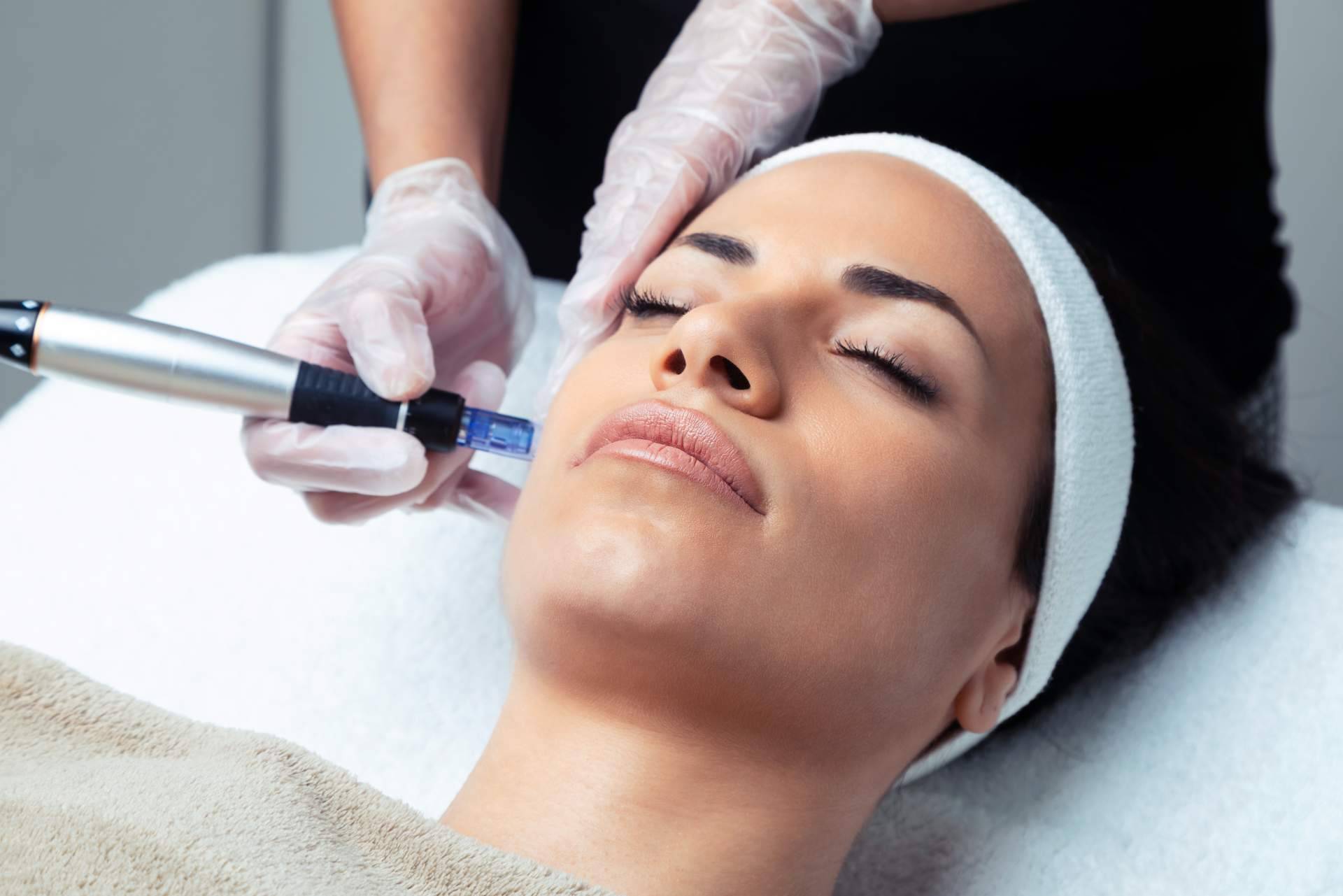 Los beneficios de la mesoterapia facial de VG Virginia Gómez