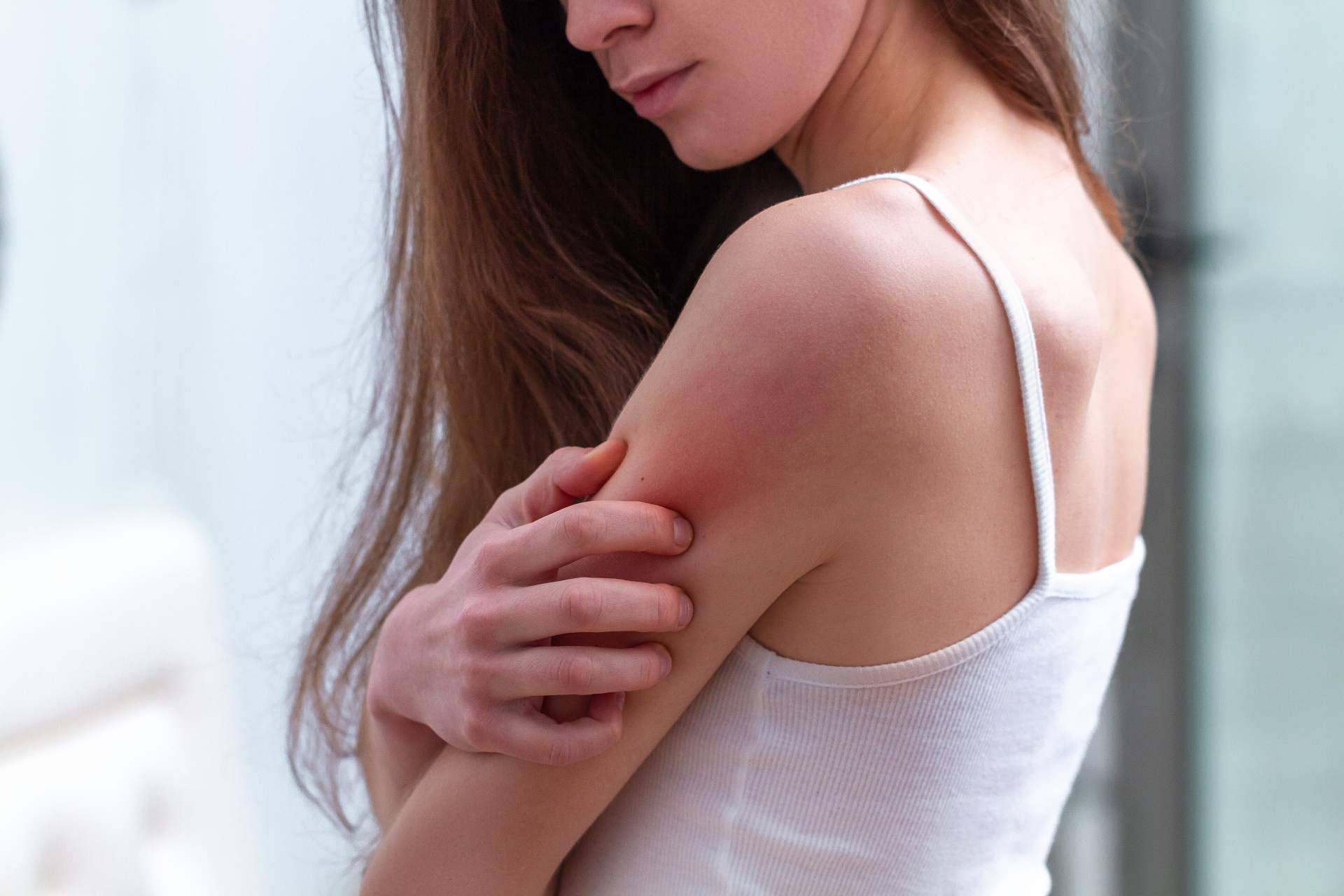 El tratamiento natural psoriasis corporal sin cortisona de Laboratorio Géomer