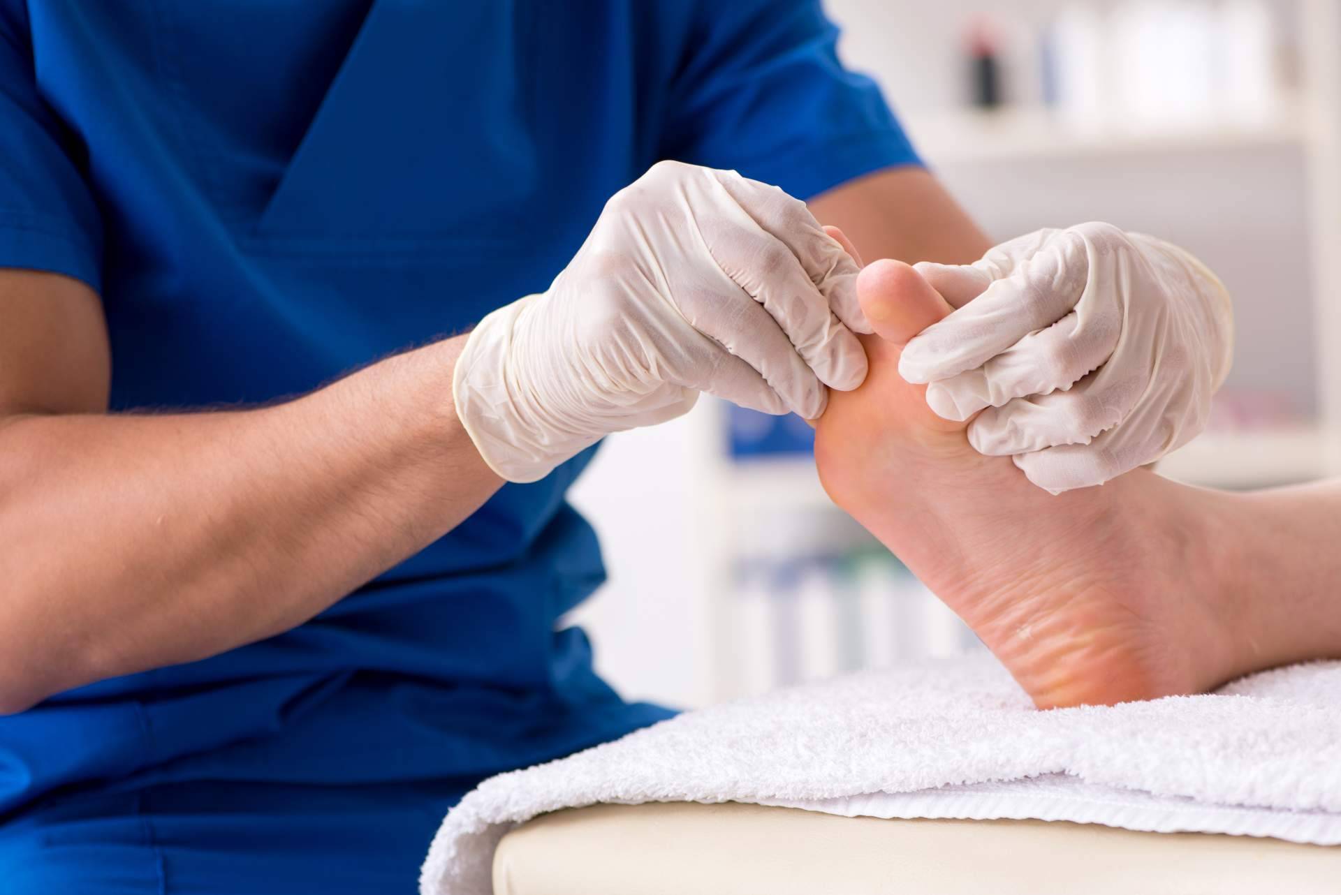 La importancia de acudir al podólogo, soluciones y tratamientos para los hongos en los pies por Clínica de Podología Integral Pododerm