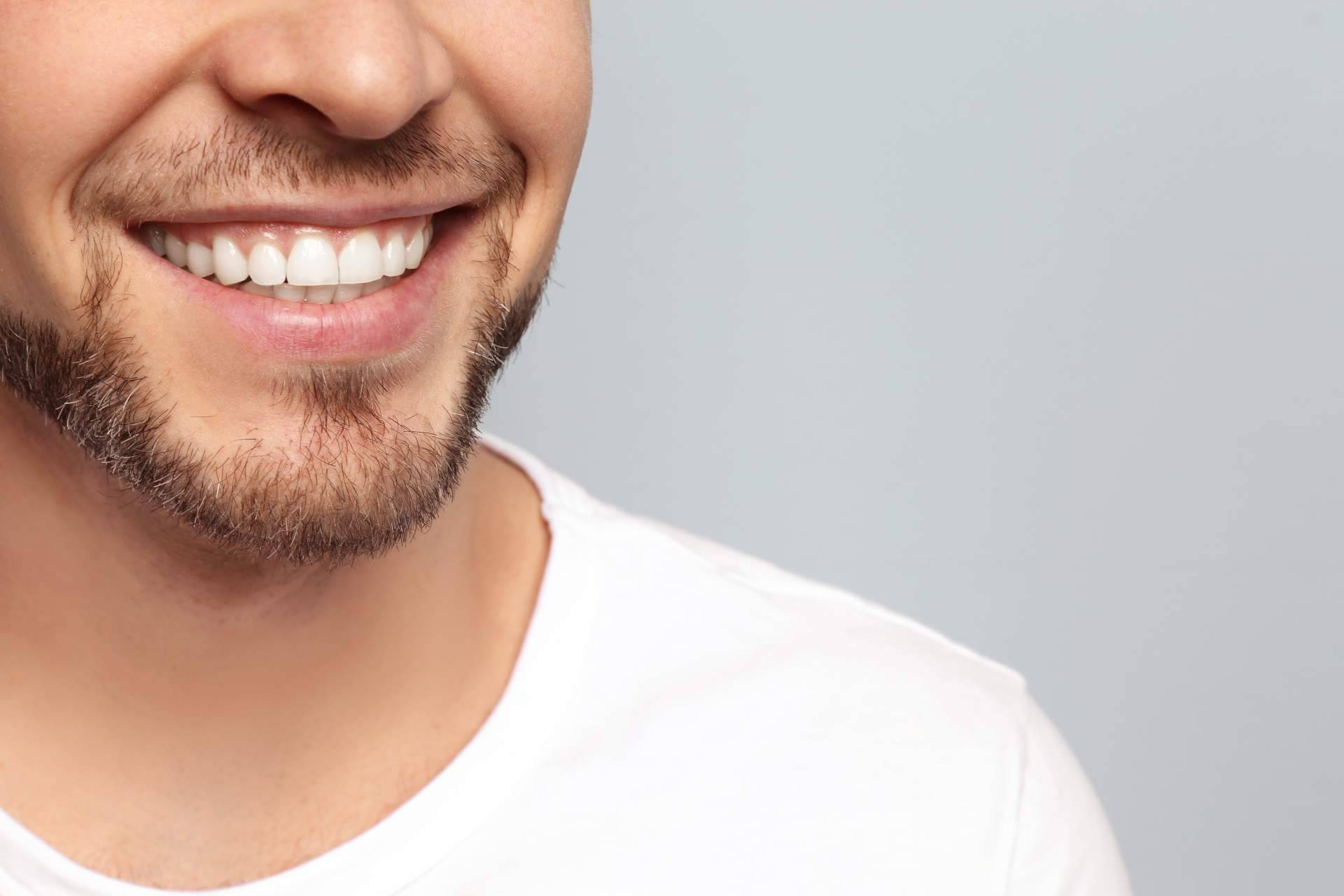 Aplicación de carillas dentales en la clínica experta de Carlos Saiz Smile