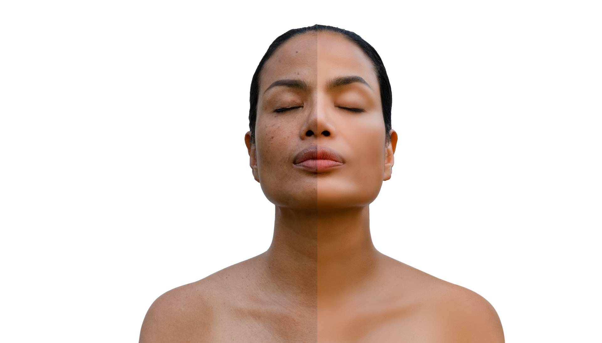 La búsqueda segura del envejecimiento saludable y de los resultados naturales con la medicina estética y well aging