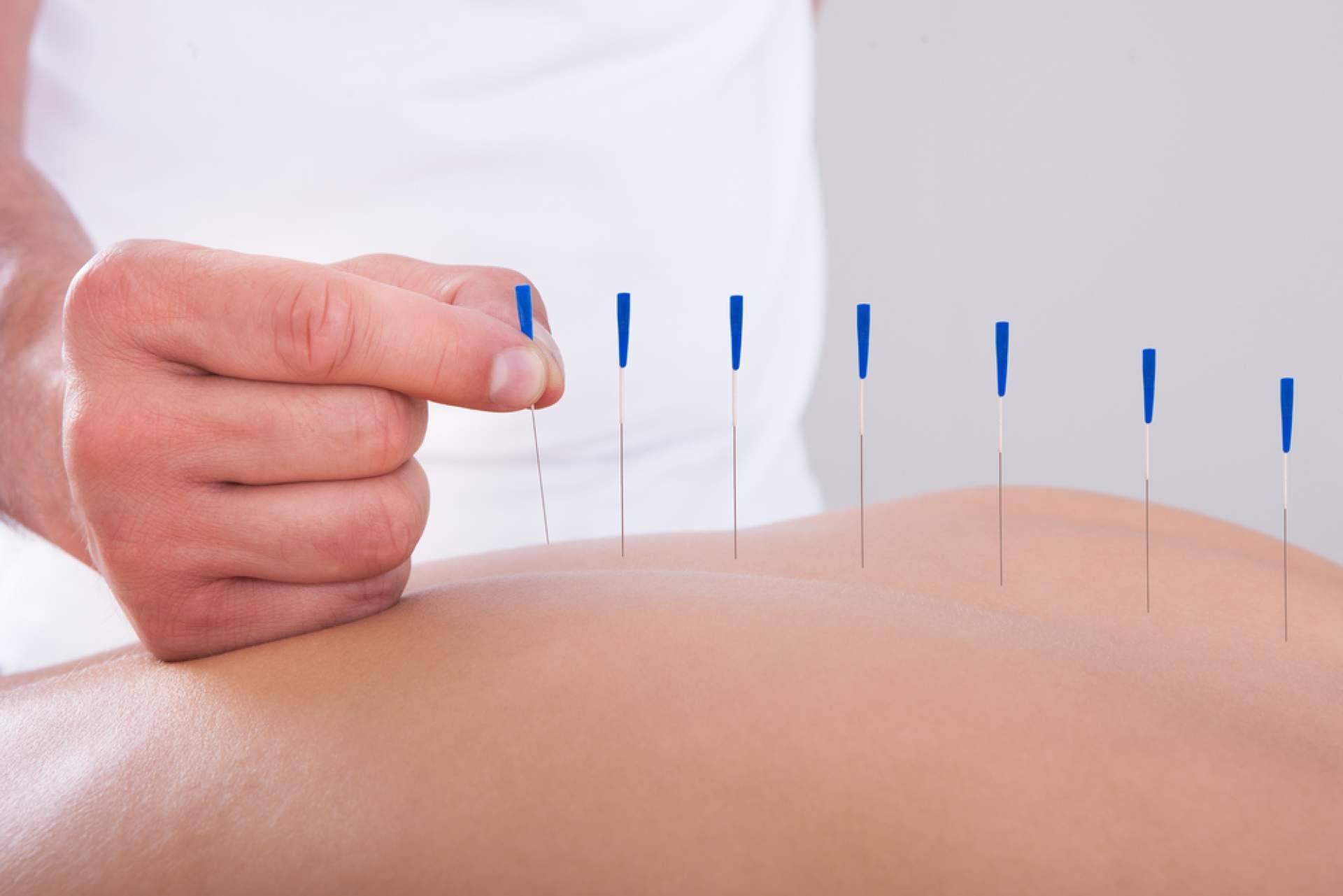 Shenti Wellness afirma que la acupuntura tiene múltiples beneficios para la fertilidad