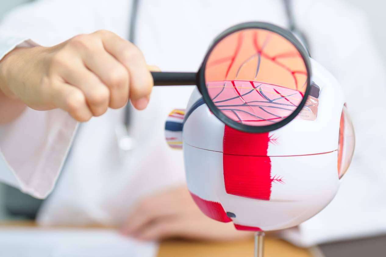 El Departamento de Oftalmología del Instituto Universitario Dexeus explica en qué consiste la retinopatía diabética